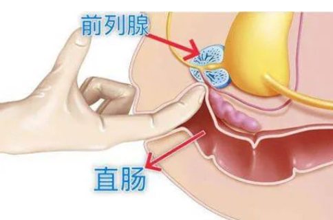 是時(shí)候重視了，1分鐘自測(cè)前列腺健康，達(dá)標(biāo)的不多